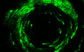 Human Metapneumovirus with Green Fluorescent Protein (MPV-GFP1)