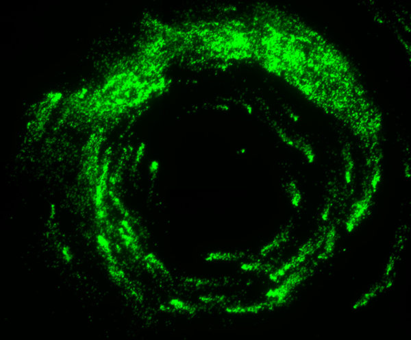 Human Metapneumovirus with Green Fluorescent Protein (MPV-GFP1)