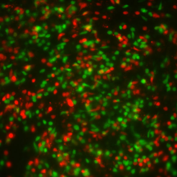 Human Respiratory Syncytial Virus with Red Fluorescent Protein (RSV-RFP1) - Image 2
