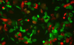 Human Respiratory Syncytial Virus with Red Fluorescent Protein (RSV-RFP1)