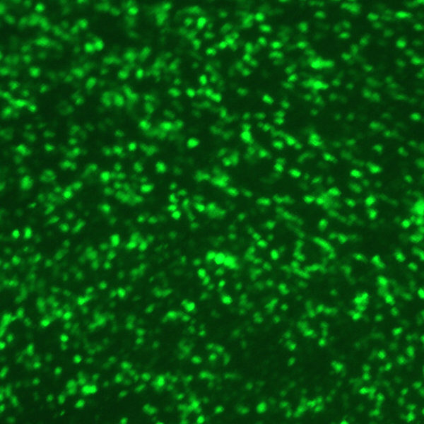 Human Respiratory Syncytial Virus with Green Fluorescent Protein (RSV-GFP1) - Image 2