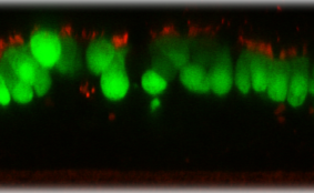Human Respiratory Syncytial Virus with Green Fluorescent Protein (RSV-GFP1)