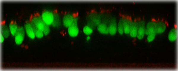 Human Respiratory Syncytial Virus with Green Fluorescent Protein (RSV-GFP1)