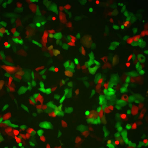 Respiratory Syncytial Virus