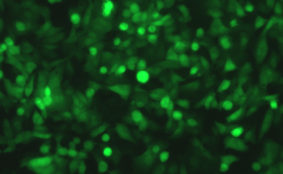 Respiratory Syncytial Virus with enhanced Green Fluorescent Protein (RSV-GFP5)