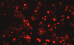 Respiratory Syncytial Virus with DsRed2 Red Fluorescent Protein (RSV-DsRed5)