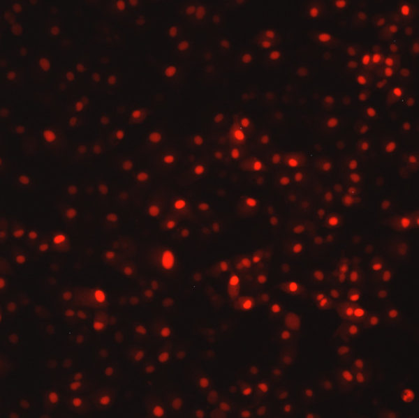 Respiratory Syncytial Virus with DsRed2 Red Fluorescent Protein (RSV-DsRed5) - Image 2