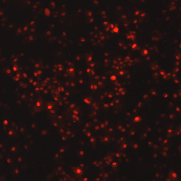 Respiratory Syncytial Virus with DsRed2 Red Fluorescent Protein (RSV-DsRed5) - Image 3