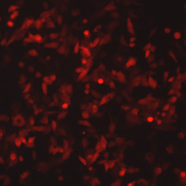 Respiratory Syncytial Virus with mKate2 Far Red Fluorescent Protein (RSV-FarRed5)