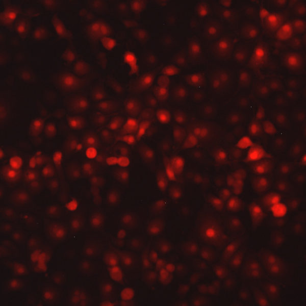 Respiratory Syncytial Virus with mKate2 Far Red Fluorescent Protein (RSV-FarRed5) - Image 3