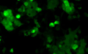 Human Respiratory Syncytial Virus Subgroup B with Green Fluorescent Protein (RSVB-GFP3)